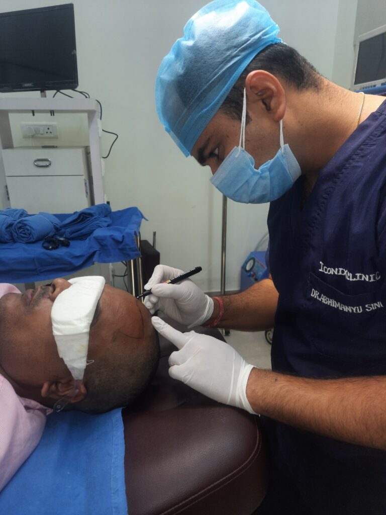 dr abhimanyu singh hair transplant picture